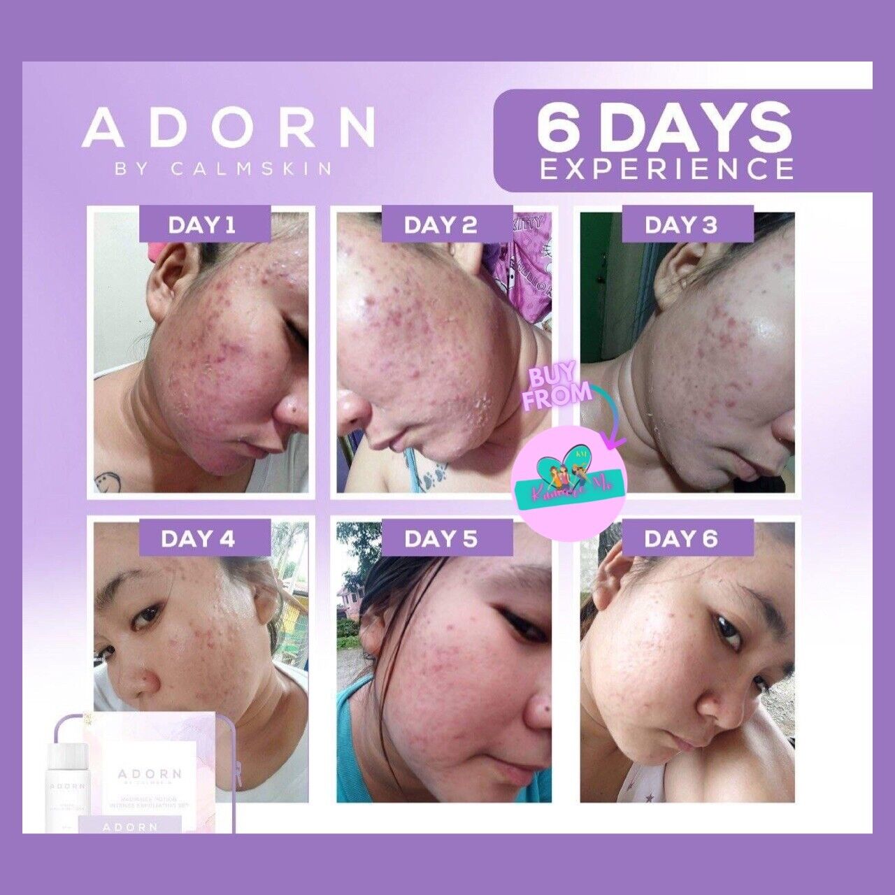ADORN by CalmSkinย Radiance Potion Intense Exfoliating Set